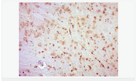 6057fe2f11a6e.png image.png